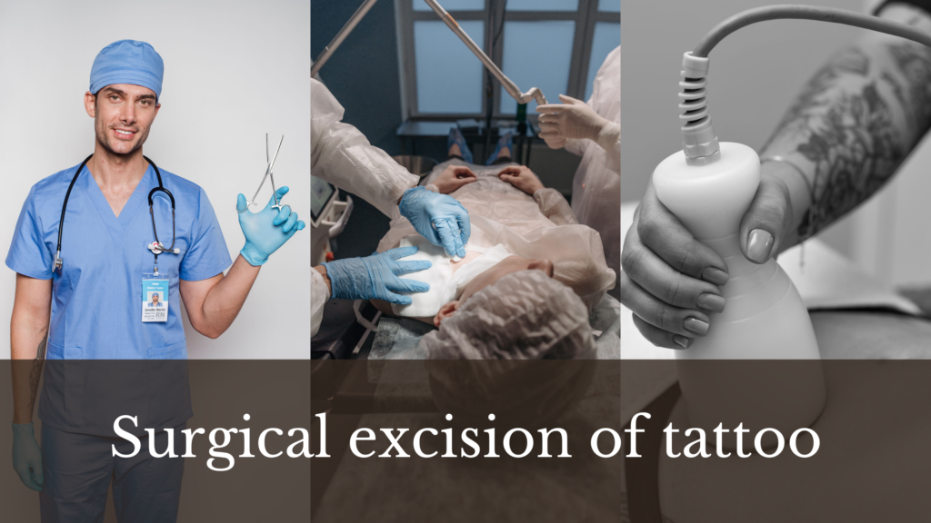 Surgical excision of tattoo