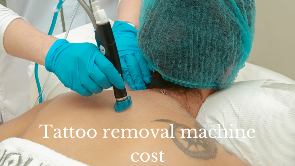 tattoo removal machine cost