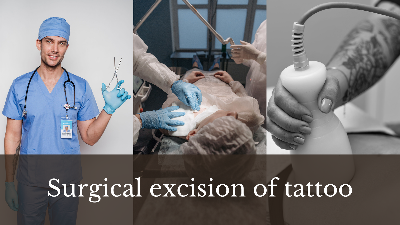 Surgical excision of tattoo